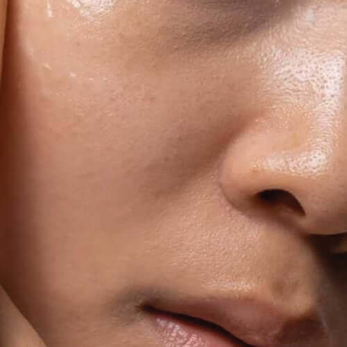 skin-combination.jpg__PID:0225351d-a97c-4686-b42c-a9a37ee13def