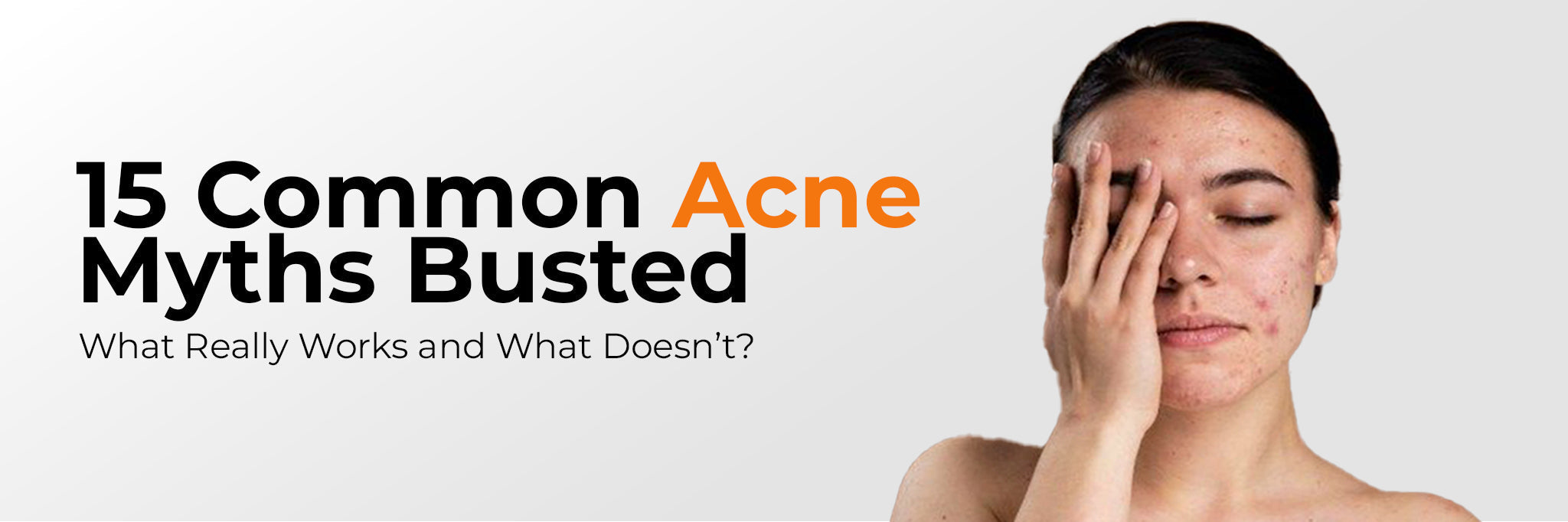 Acne Myths vs Facts: 15 Beliefs Dermatology Doesn’t Support