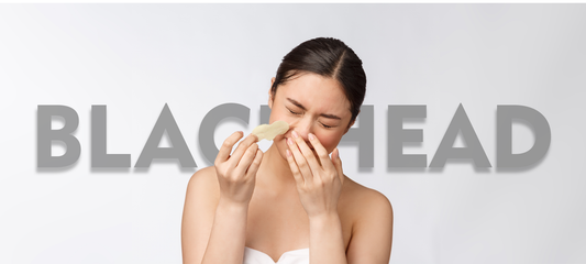 How to Remove Blackheads from Your Nose: A Complete Guide