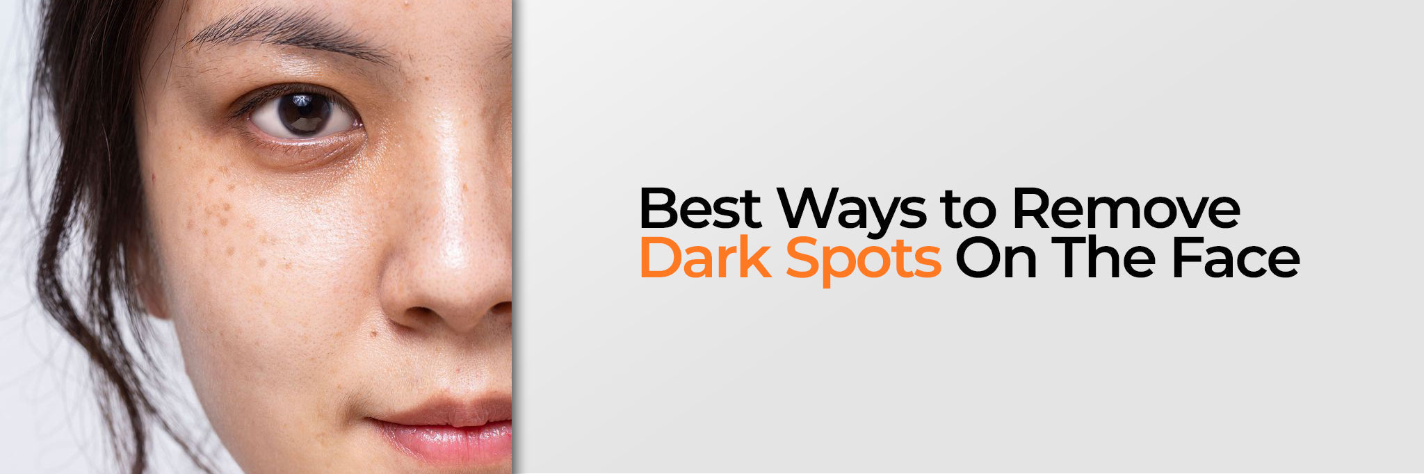 How to Fade Dark Spots on the Face: Causes and Treatment Options