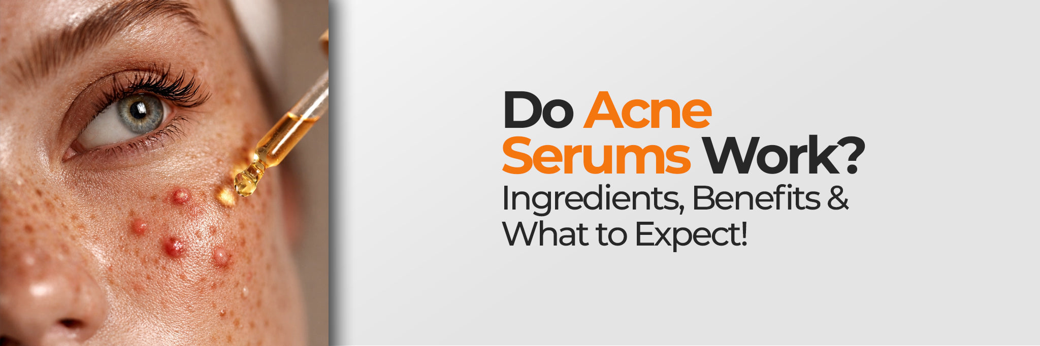 Do Acne Serums Really Work? Ingredients, Results and Timelines