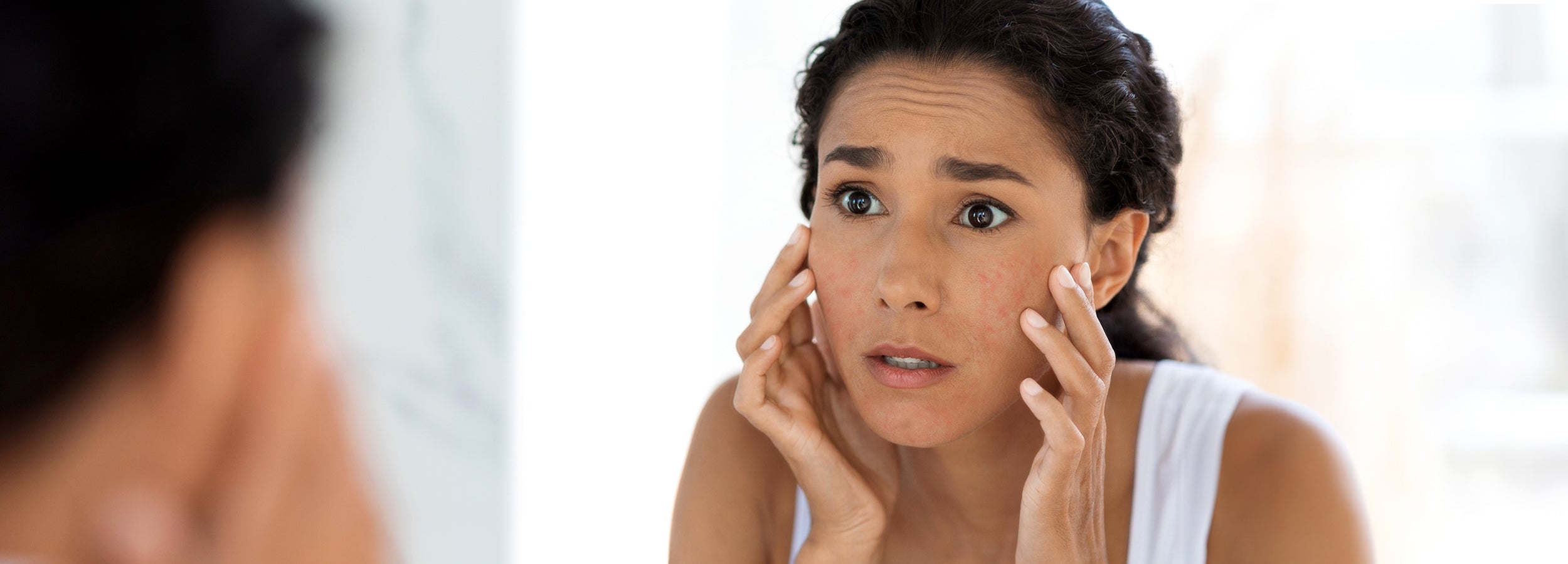 Effective Skincare Routine for Pimple-Prone Skin: Clear and Radiant