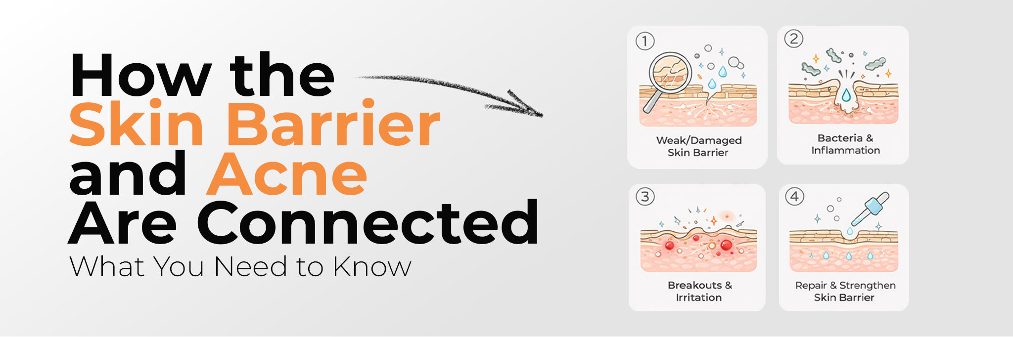 Can a Damaged Skin Barrier Cause Acne? Signs and Repair Tips
