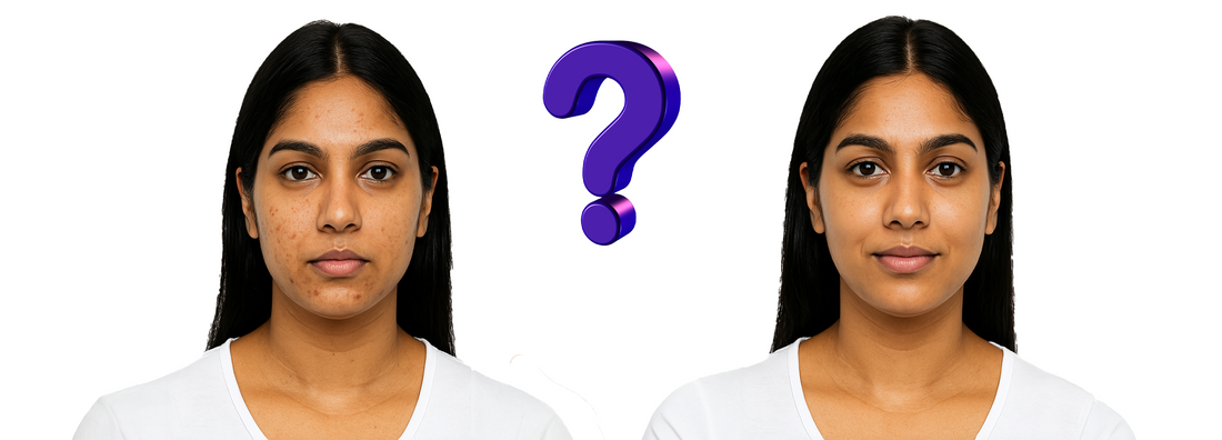 How to Get Clear Skin: Uncover Quick and Easy Tips