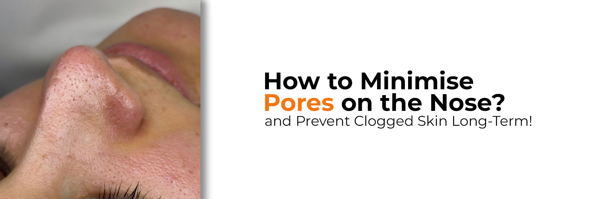 Nose Pores: Minimise Their Appearance and Prevent Clogs