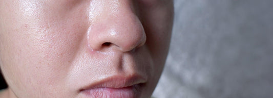 Best Skincare Routine for Oily Skin