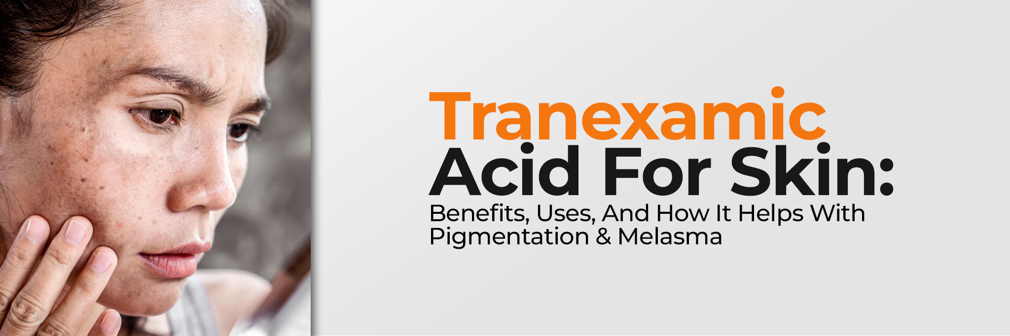 Tranexamic Acid for Pigmentation and Melasma: Benefits and Safe Use