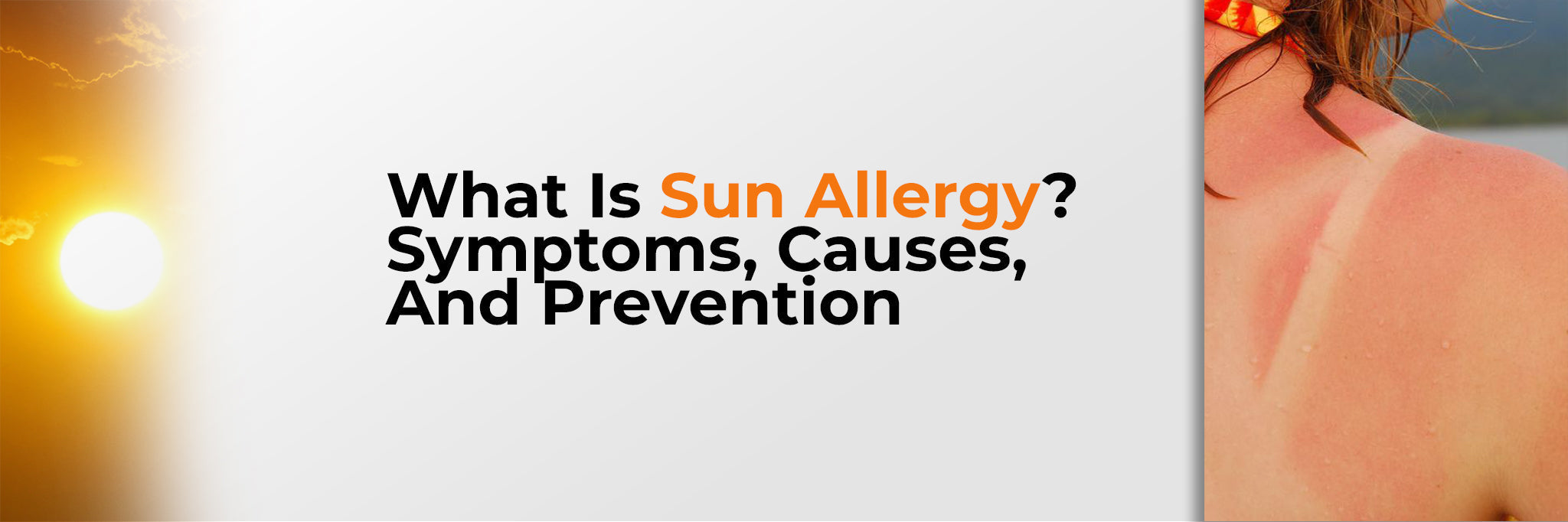 Sun Allergy Explained: Symptoms, Causes and Prevention