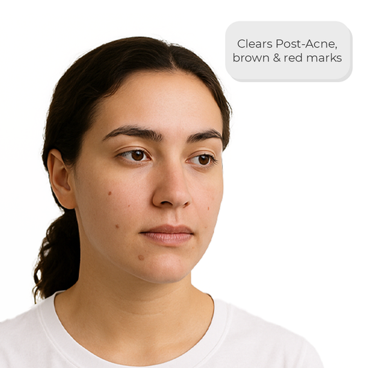 CLARIFI BC Serum