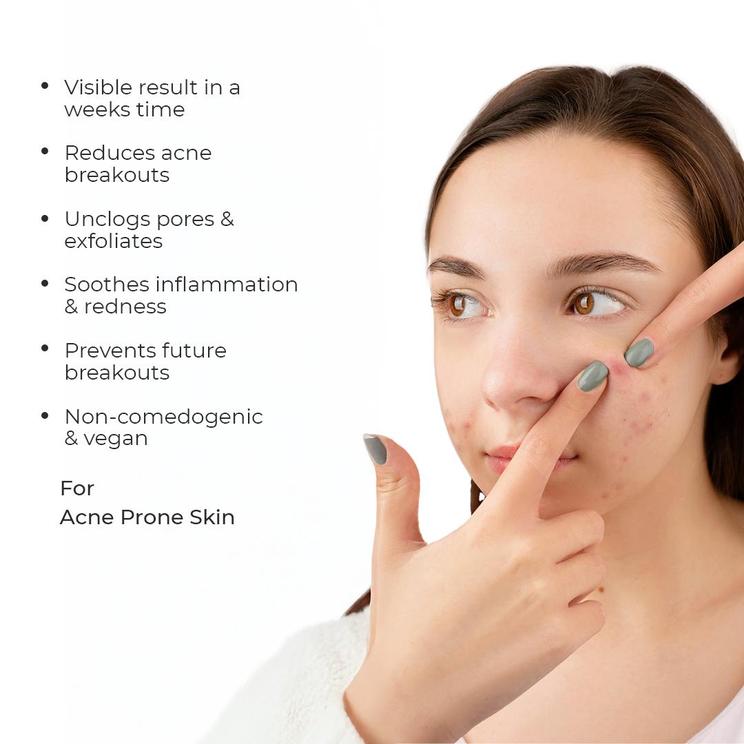 CLARIFI AC Serum - Acne Control Serum