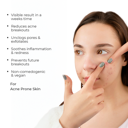 CLARIFI AC Serum - Acne Control Serum