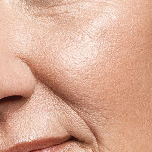 Skin-wrinkle.jpg__PID:f42ca9a3-7ee1-4def-9a94-4eb9e41d3988