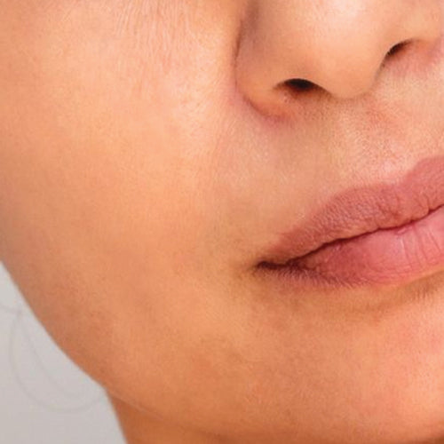 skin-normal.jpg__PID:a97c2686-f42c-49a3-bee1-3def9a944eb9